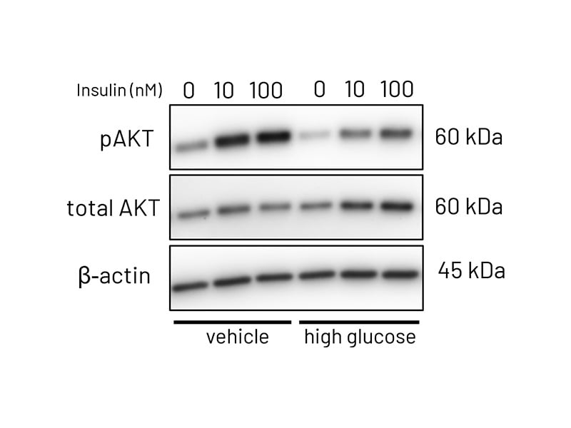 MASLD page Fig 3a