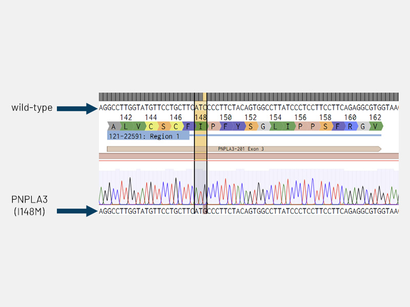 MASLD page Fig 5a