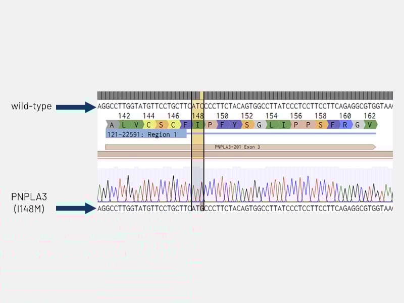 MASLD page Fig 5a