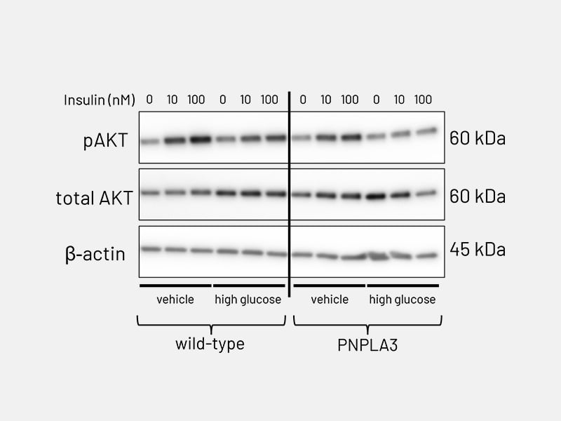 MASLD page Fig 6bv2