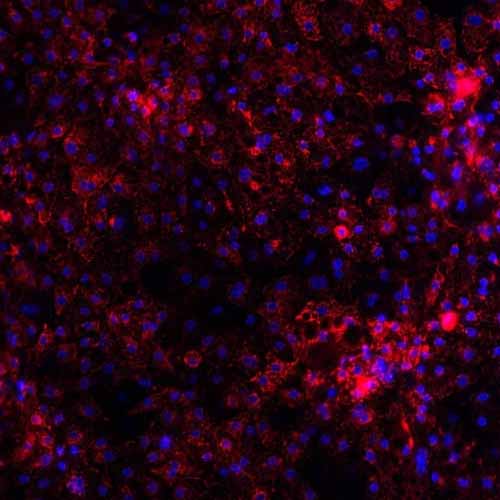 def008_models_Wilsons-Disease_v1