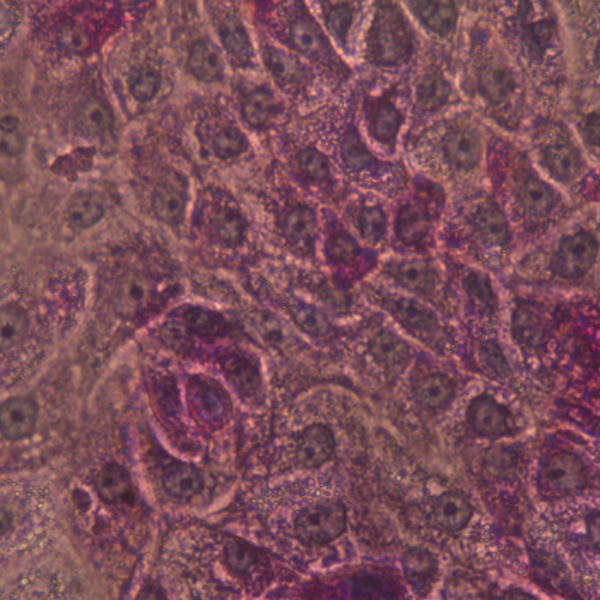DefiniGEN GSD1a PAS staining showing breakdown of accumulated glycogen_Cell_product_Image_600x600